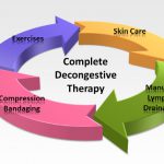 Complete Decongestive Therapy (CDT) for Lymphedema