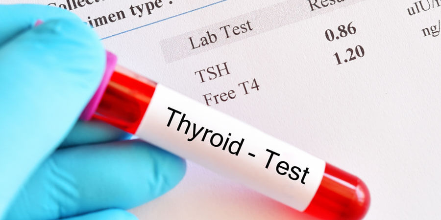 Full Thyroid Tests Panel