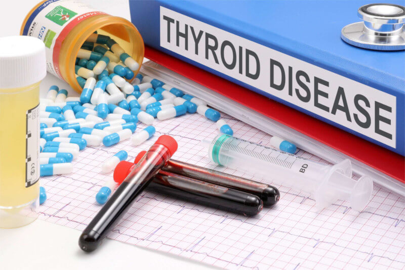 Thyroid Conditions and Disease