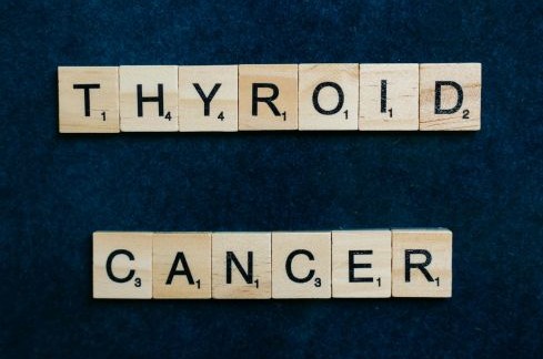 Thyroid Cancer